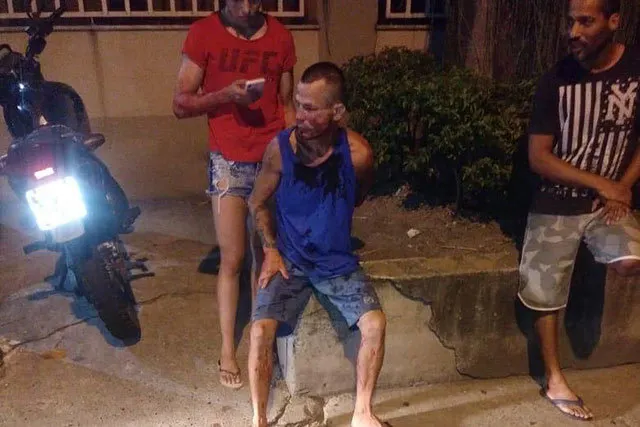 Вор напал на женщину из UFC. Теперь его лицо красивее любого чемпионского пояса