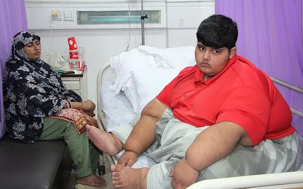 10-летний пакистанец весит почти 200 килограммов. Он не может ходить, но врачи его спасут