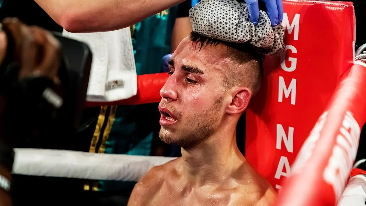 Скончался российский боксер Максим Дадашев. После недавнего боя он перенес трепанацию черепа и впал в кому