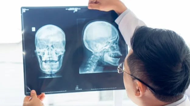 В TikTok набрал популярность глупый и опасный skull-breaker challenge. И у него уже есть первые жертвы