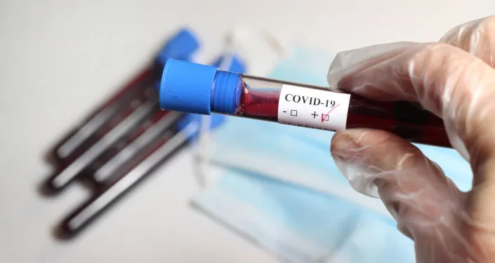 «Поучительная история для любителей потусить». Блогерша из твиттера заразилась ковидом и умерла