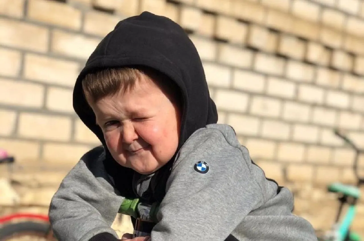 Почему будущий боец MMA Хасбик выглядит как пожилой младенец? Врач сравнил его с Лионелем Месси