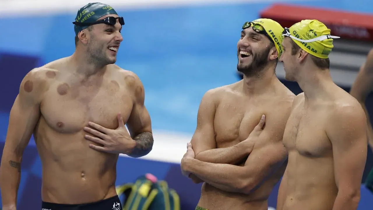 На Олимпиаде зрители удивились красным отметинам на спортсменах. Так в мире узнали про старый советский метод лечения