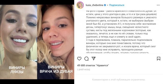Люся Чеботина против стоматолога и виниров