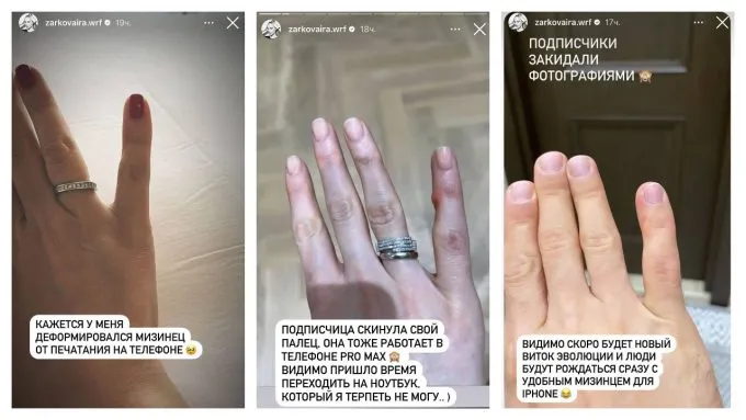 Деформация мизинца при использовании смартфона